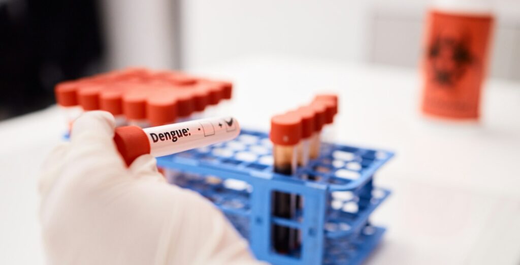 Blood, test or hands of scientist with vaccine in a science laboratory with innovation, dna and rna
