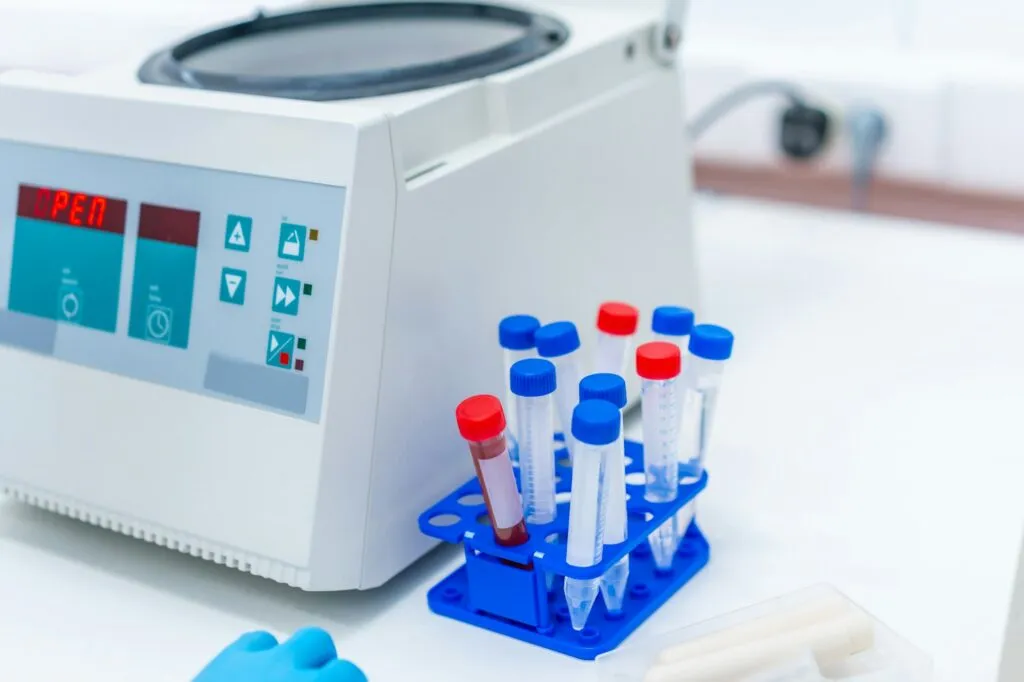 Centrifuge machine and blood samples in a laboratory